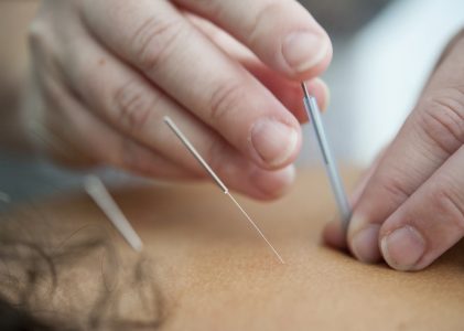 Traditionelle chinesische Medizin – Wirkprinzipien und moderne Anwendungen