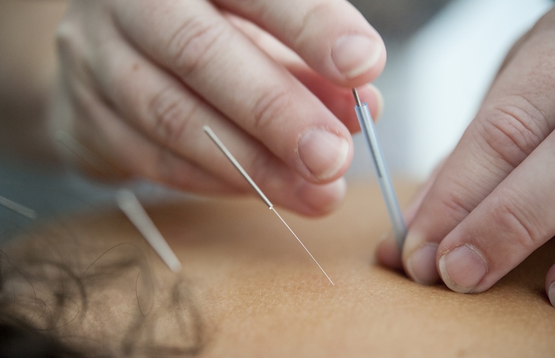 Traditionelle chinesische Medizin – Wirkprinzipien und moderne Anwendungen